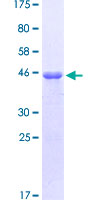 LEF1 Protein - 12.5% SDS-PAGE Stained with Coomassie Blue.