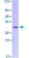 LEFTYB / LEFTY1 Protein - 12.5% SDS-PAGE Stained with Coomassie Blue.