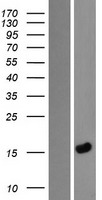 LEMD1 Protein - Western validation with an anti-DDK antibody * L: Control HEK293 lysate R: Over-expression lysate
