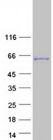 LEMD2 Protein - Purified recombinant protein LEMD2 was analyzed by SDS-PAGE gel and Coomassie Blue Staining