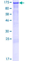 LEO1 Protein - 12.5% SDS-PAGE of human LEO1 stained with Coomassie Blue