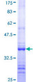 LEPR / Leptin Receptor Protein - 12.5% SDS-PAGE Stained with Coomassie Blue.
