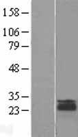 LEPROT Protein - Western validation with an anti-DDK antibody * L: Control HEK293 lysate R: Over-expression lysate