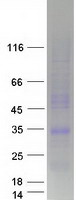 LEPROTL1 Protein - Purified recombinant protein LEPROTL1 was analyzed by SDS-PAGE gel and Coomassie Blue Staining