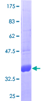 Leptin Protein - 12.5% SDS-PAGE of human LEP stained with Coomassie Blue