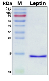 Leptin Protein - SDS-PAGE under reducing conditions and visualized by Coomassie blue staining