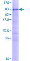 LEREPO4 / ZC3H15 Protein - 12.5% SDS-PAGE of human ZC3H15 stained with Coomassie Blue
