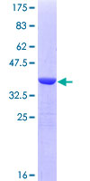 LETM1 Protein - 12.5% SDS-PAGE Stained with Coomassie Blue