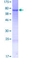 LETM2 Protein - 12.5% SDS-PAGE of human LETM2 stained with Coomassie Blue