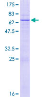 LETMD1 / HCCR1 Protein - 12.5% SDS-PAGE of human LETMD1 stained with Coomassie Blue