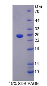 LETMD1 / HCCR1 Protein - Recombinant  LETM1 Domain Containing Protein 1 By SDS-PAGE