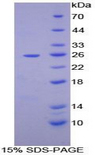 Leucine Aminopeptidase Protein - Recombinant Leucine Aminopeptidase By SDS-PAGE