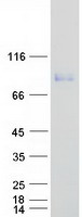 LF / LTF / Lactoferrin Protein - Purified recombinant protein LTF was analyzed by SDS-PAGE gel and Coomassie Blue Staining