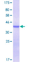 LGALS1 / Galectin 1 Protein - 12.5% SDS-PAGE of human LGALS1 stained with Coomassie Blue
