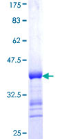 LGALS1 / Galectin 1 Protein - 12.5% SDS-PAGE Stained with Coomassie Blue