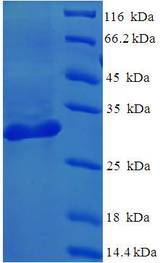LGALS1 / Galectin 1 Protein