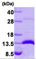 LGALS1 / Galectin 1 Protein