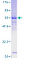 LGALS12 / Galectin 12 Protein - 12.5% SDS-PAGE of human LGALS12 stained with Coomassie Blue