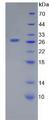 LGALS12 / Galectin 12 Protein - Recombinant Galectin 12 By SDS-PAGE