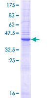 LGALS14 / CLC2 Protein - 12.5% SDS-PAGE of human LGALS14 stained with Coomassie Blue