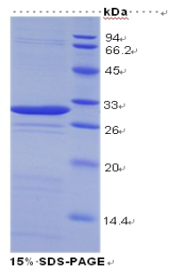 LGALS3 / Galectin 3 Protein - Recombinant Galectin 3 By SDS-PAGE