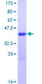 LGALS7 / Galectin 7 Protein - 12.5% SDS-PAGE of human LGALS7 stained with Coomassie Blue