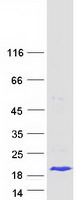 LGALS7B Protein - Purified recombinant protein LGALS7B was analyzed by SDS-PAGE gel and Coomassie Blue Staining