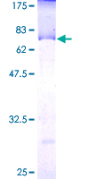 LGALS8 / Galectin 8 Protein - 12.5% SDS-PAGE of human LGALS8 stained with Coomassie Blue