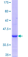 LGALS8 / Galectin 8 Protein - 12.5% SDS-PAGE Stained with Coomassie Blue.