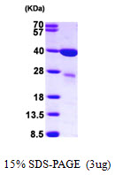 LGALS8 / Galectin 8 Protein