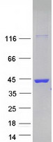 LGALS8 / Galectin 8 Protein - Purified recombinant protein LGALS8 was analyzed by SDS-PAGE gel and Coomassie Blue Staining