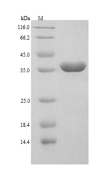 LGALS9 / Galectin 9 Protein - (Tris-Glycine gel) Discontinuous SDS-PAGE (reduced) with 5% enrichment gel and 15% separation gel.