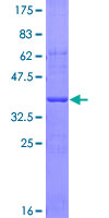 LGALS9 / Galectin 9 Protein - 12.5% SDS-PAGE Stained with Coomassie Blue.