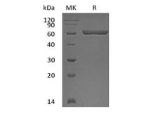 LGALS9 / Galectin 9 Protein - Recombinant Human Galectin-9/LGALS9 (N-GST)