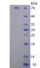 LGALS9 / Galectin 9 Protein - Recombinant  Galectin 9 By SDS-PAGE
