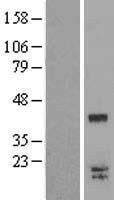LGALS9C Protein - Western validation with an anti-DDK antibody * L: Control HEK293 lysate R: Over-expression lysate