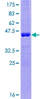 LGALSL / Galectin 5 Protein - 12.5% SDS-PAGE of human HSPC159 stained with Coomassie Blue