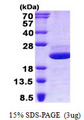 LGALSL / Galectin 5 Protein