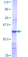 LGI3 Protein - 12.5% SDS-PAGE Stained with Coomassie Blue.