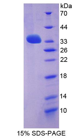 LGI3 Protein - Recombinant Leucine Rich Repeat LGI Family, Member 3 By SDS-PAGE