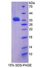 LGI3 Protein - Recombinant Leucine Rich Repeat LGI Family, Member 3 By SDS-PAGE