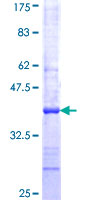 LGI4 Protein - 12.5% SDS-PAGE Stained with Coomassie Blue.