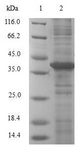 LGMN / Legumain Protein - (Tris-Glycine gel) Discontinuous SDS-PAGE (reduced) with 5% enrichment gel and 15% separation gel.