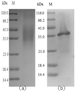 LGMN / Legumain Protein - (Tris-Glycine gel) Discontinuous SDS-PAGE (reduced) with 5% enrichment gel and 15% separation gel.