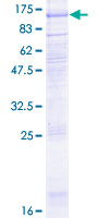 LGR6 Protein - 12.5% SDS-PAGE of human LGR6 stained with Coomassie Blue