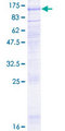 LGR6 Protein - 12.5% SDS-PAGE of human LGR6 stained with Coomassie Blue