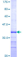 LGR6 Protein - 12.5% SDS-PAGE Stained with Coomassie Blue.