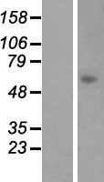 LGSN Protein - Western validation with an anti-DDK antibody * L: Control HEK293 lysate R: Over-expression lysate