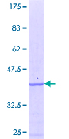 LGTN / EIF2D Protein - 12.5% SDS-PAGE Stained with Coomassie Blue.