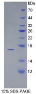 LHB / Luteinizing Hormone Protein - Recombinant Luteinizing Hormone Beta Polypeptide By SDS-PAGE
